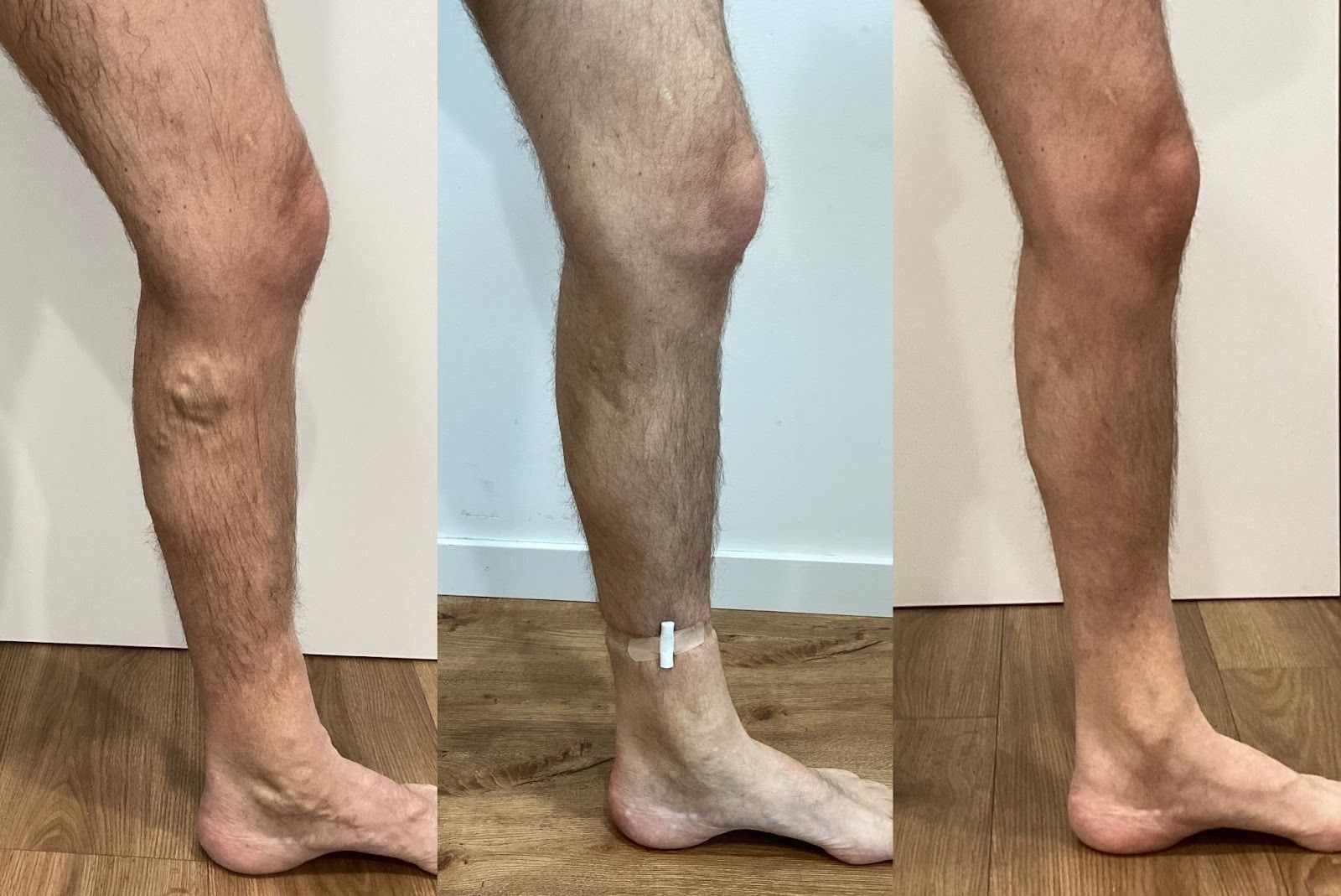 El antes y el después del tratamiento