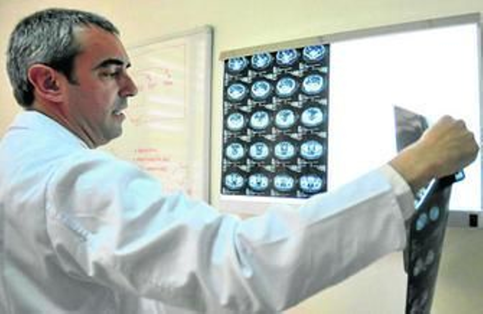 David Moreno, director de la Unidad de Dermatología en el Hospital Virgen Macarena.