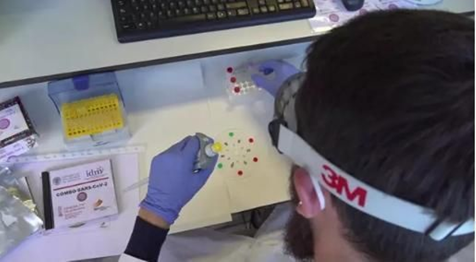 Un nuevo sistema basado en tecnologías DVD halla covid en menos de 30 minutos