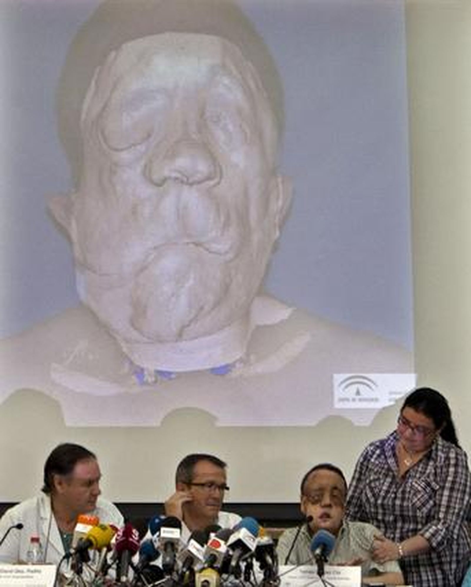 Rafael, junto a su hermana y los médicos que le realizaron el trasplante. Al fondo, imagen de Rafael antes de la intervención.  Foto: Eduardo Abad (Efe)