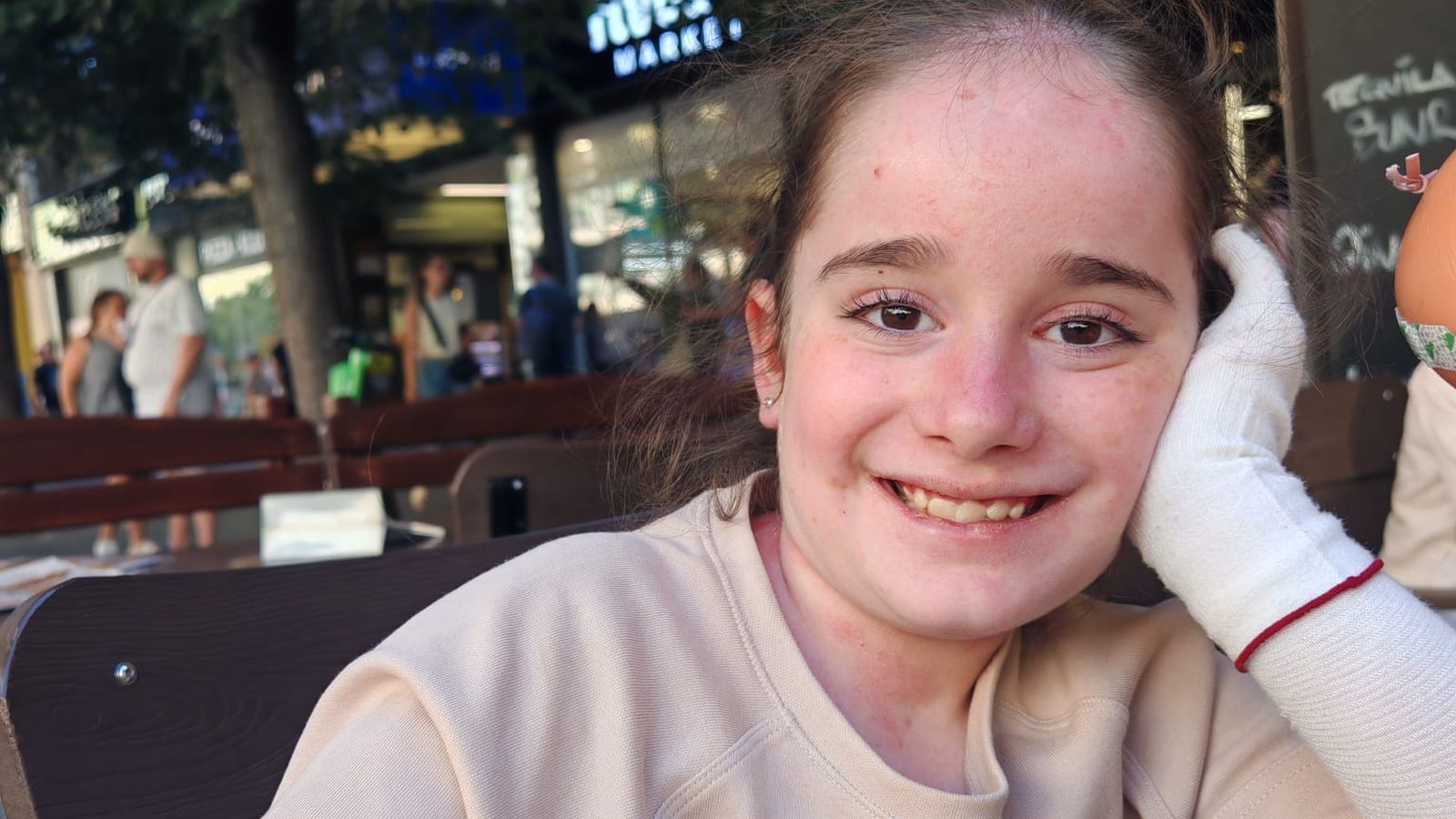 La pequeña linarense es una de las 500 personas con piel de mariposa en España.