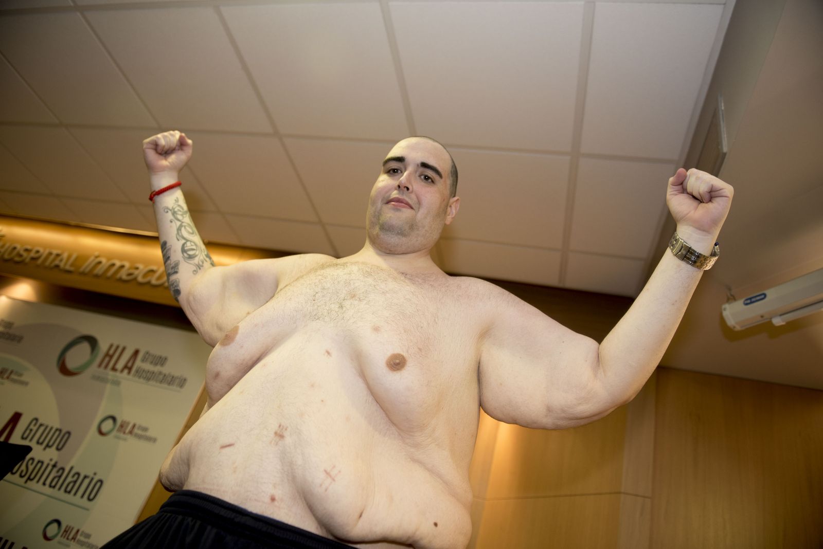 Teo Rodríguez, cuatro meses después y 200 kilos menos