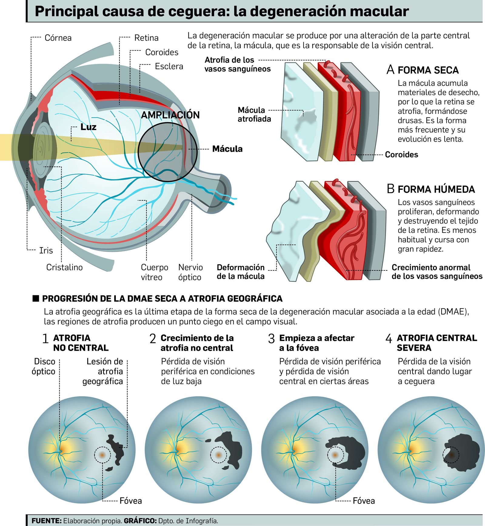 El avance de la enfermedad.
