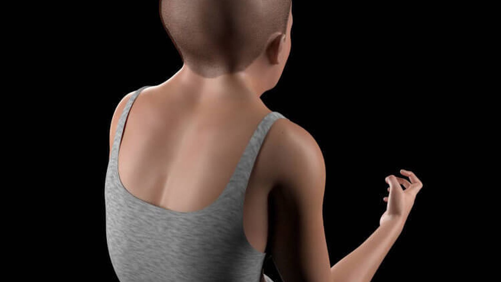 Joroba prominente en el ser humano de 2300