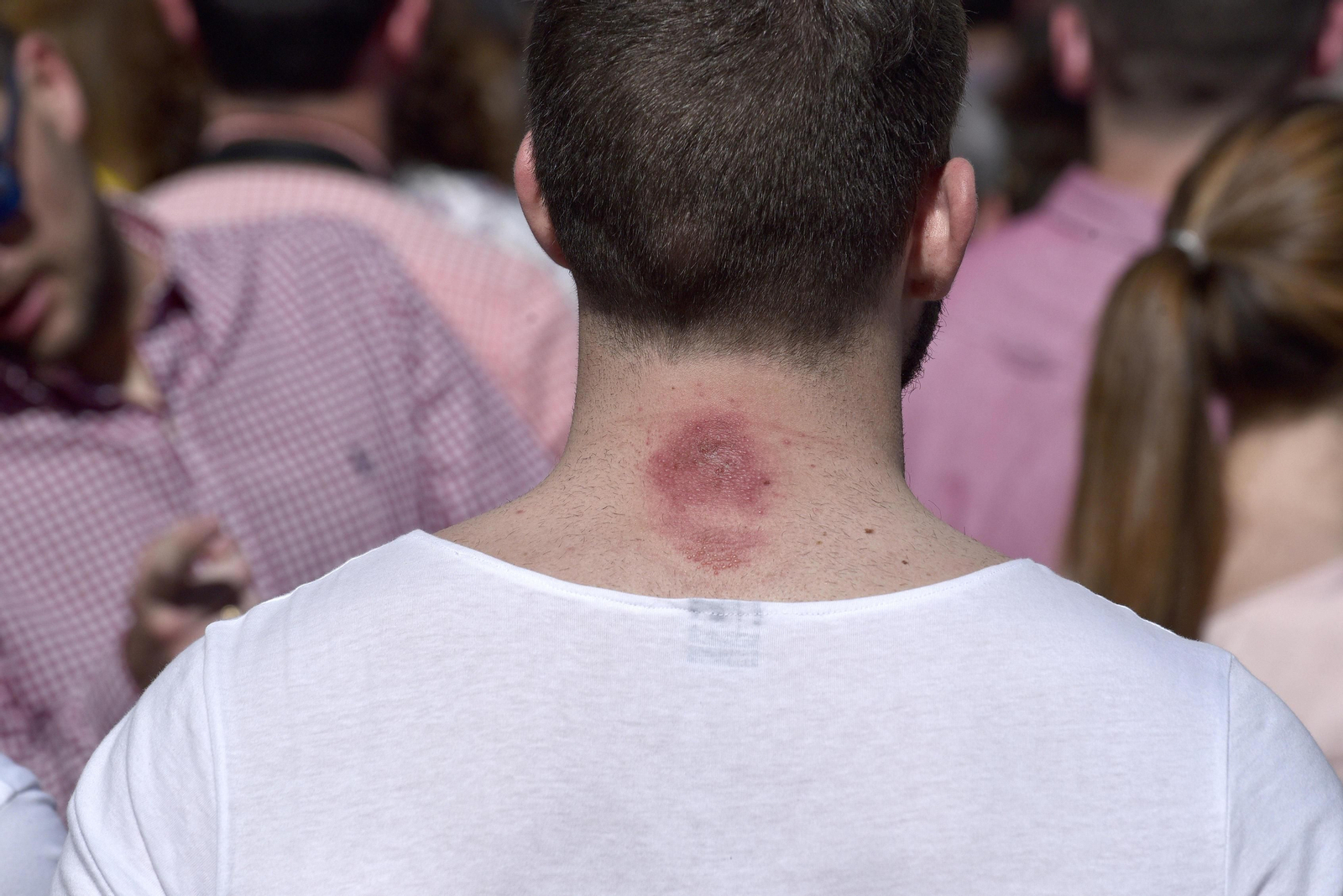 Las imágenes de San Benito