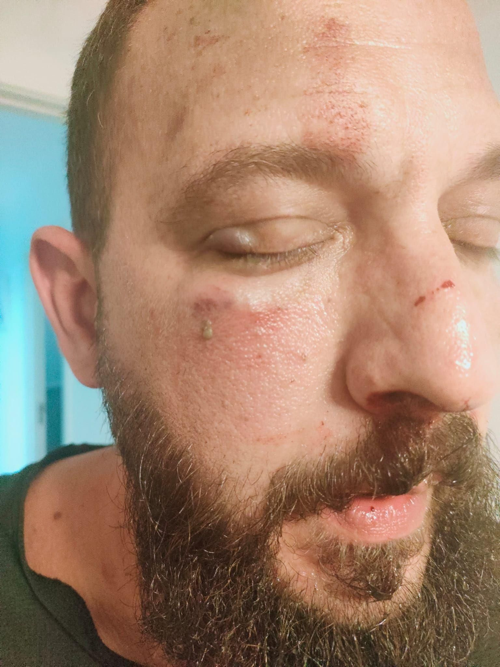 Así quedó el guardia tras la agresión. Así quedó el guardia tras la agresión.