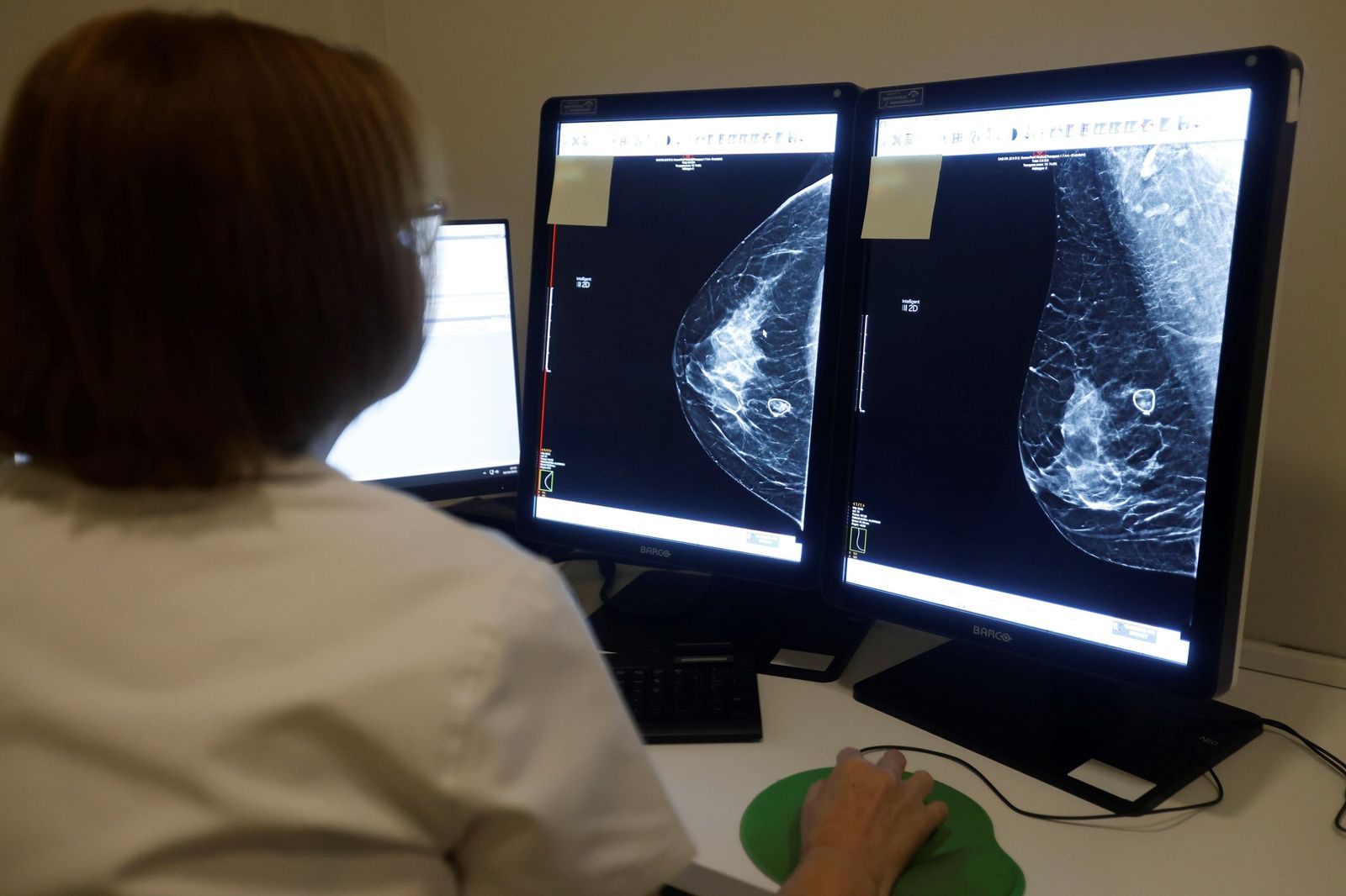 Una radióloga del Hospital Reina Sofía estudia una mamografía.