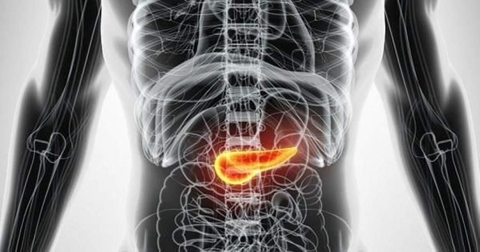 El cáncer de páncreas es uno de los más mortales.