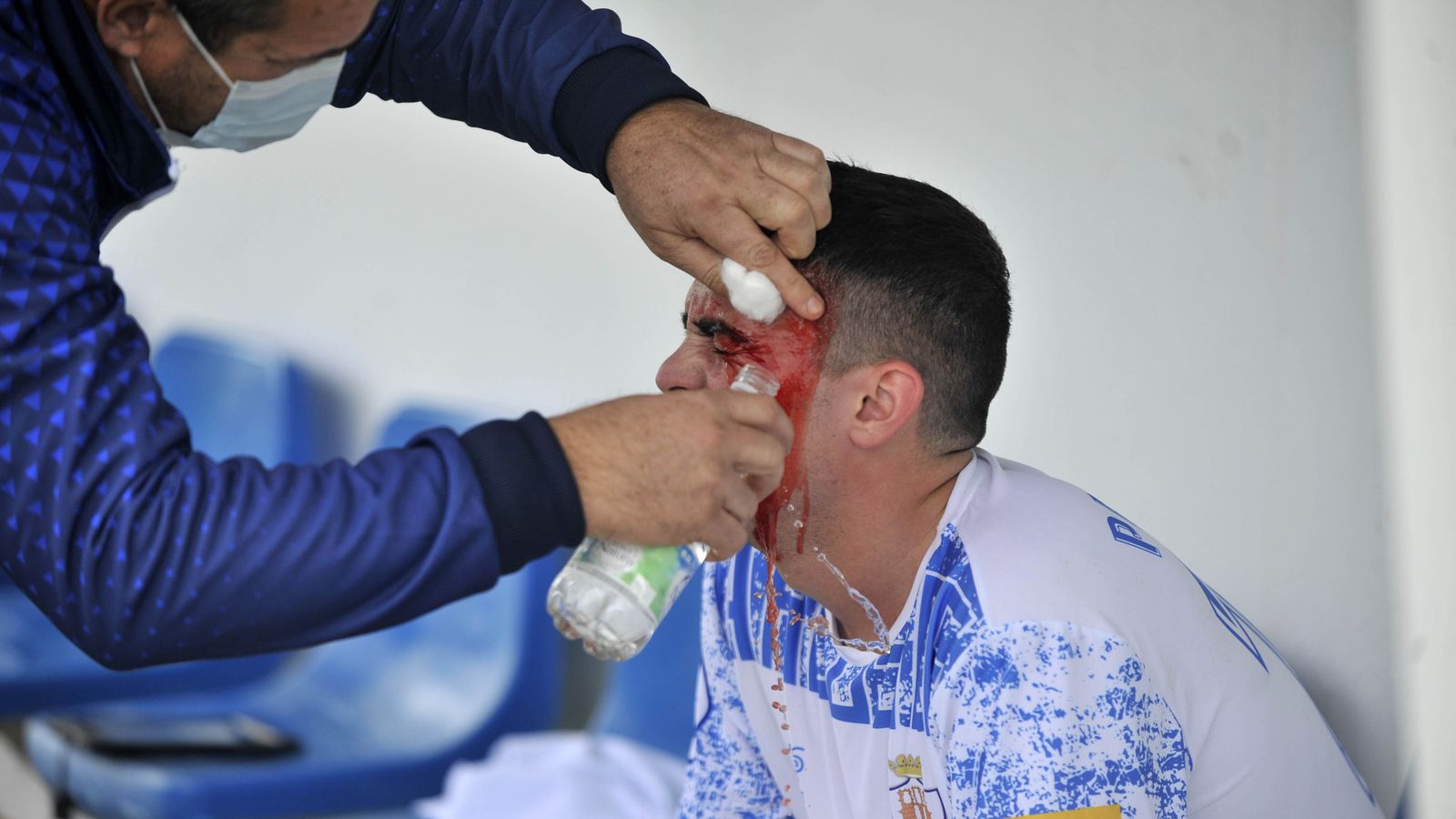 Pablo Gil tuvo que retirarse del terreno de juego con un corte en la ceja izquierda.
