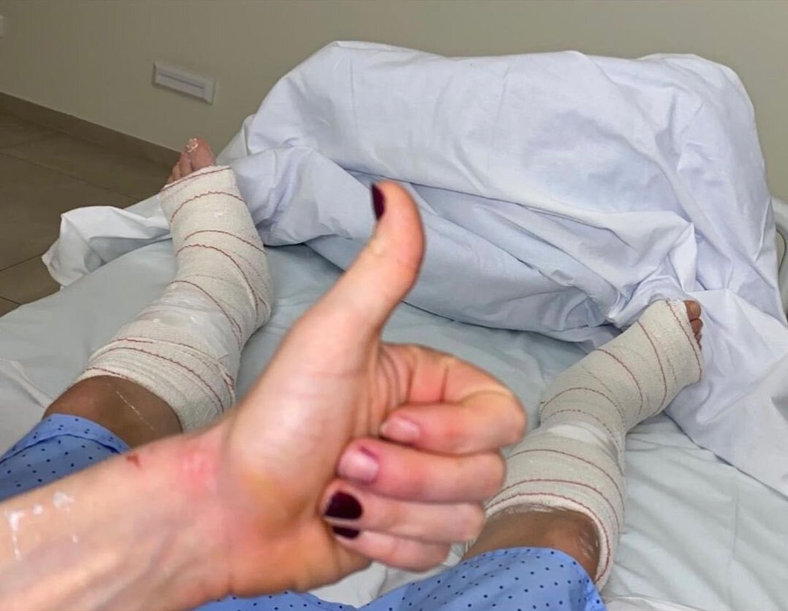 Ana Pérez muestra su lesión en ambos pies.