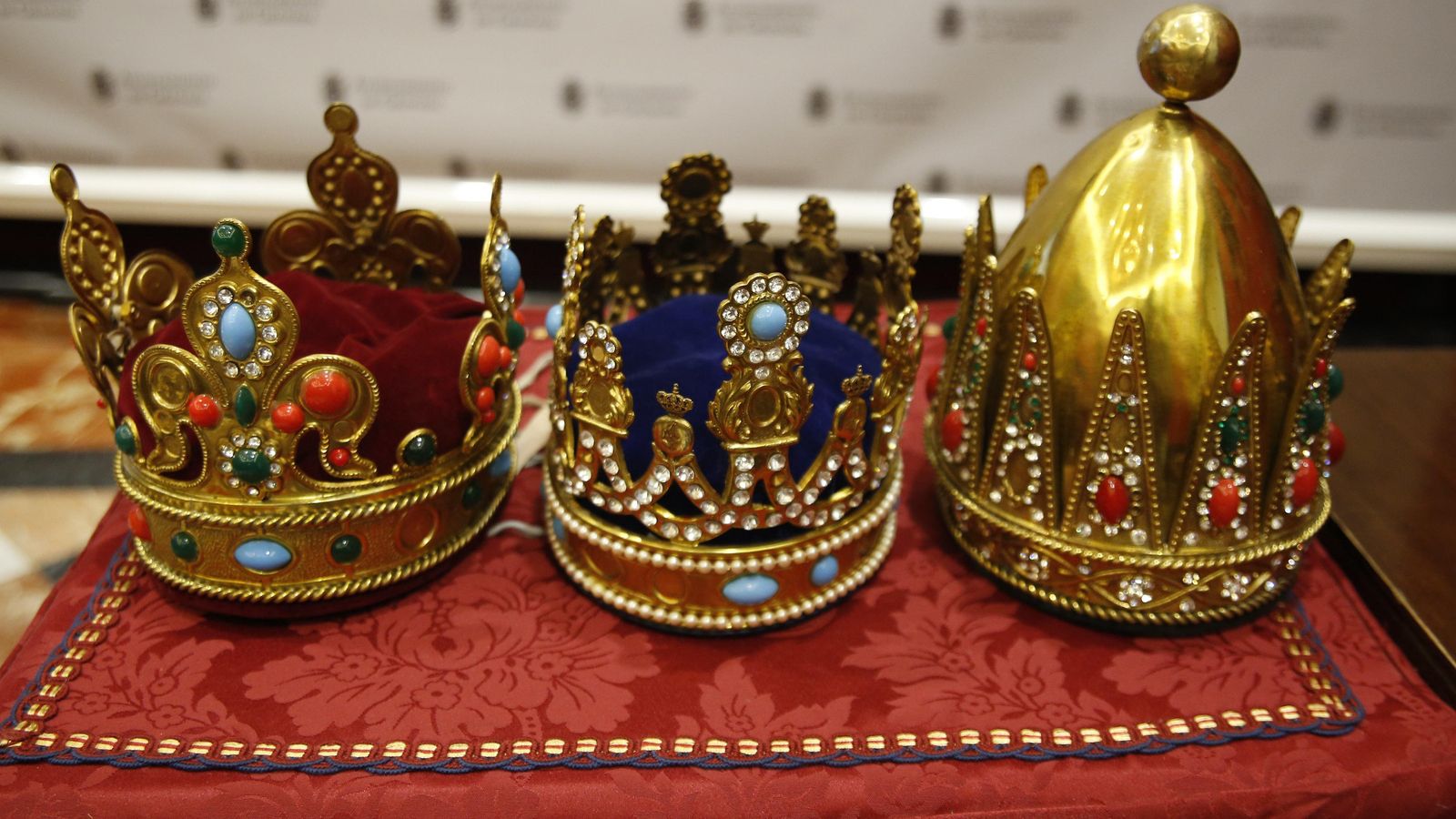 Las anteriores coronas eran rígidas y muy pesadas.