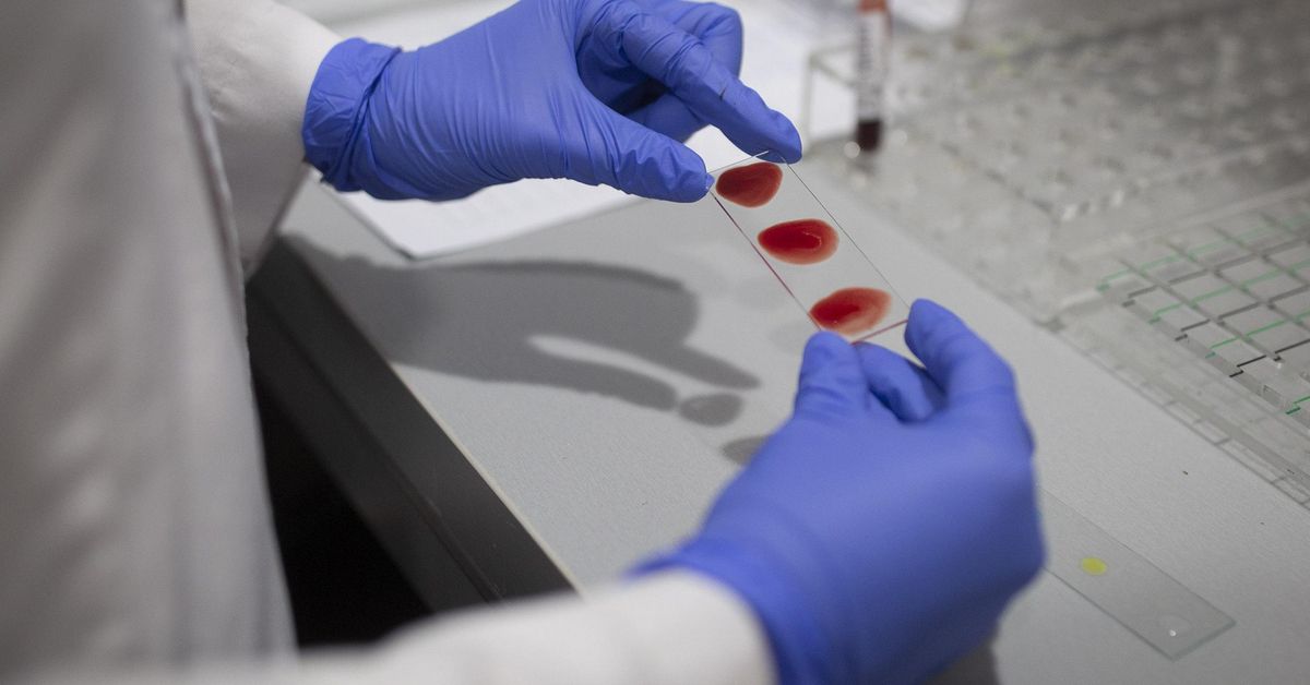 Las clínicas privadas revolucionan la detección del coronavirus