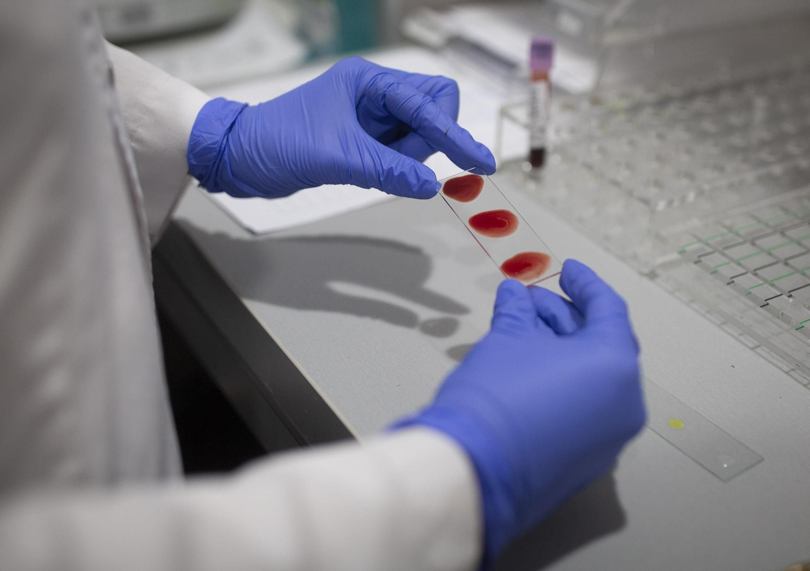 Análisis de pruebas de coronavirus en el laboratorio del Hospital Viamed Santa Ángela de la Cruz.