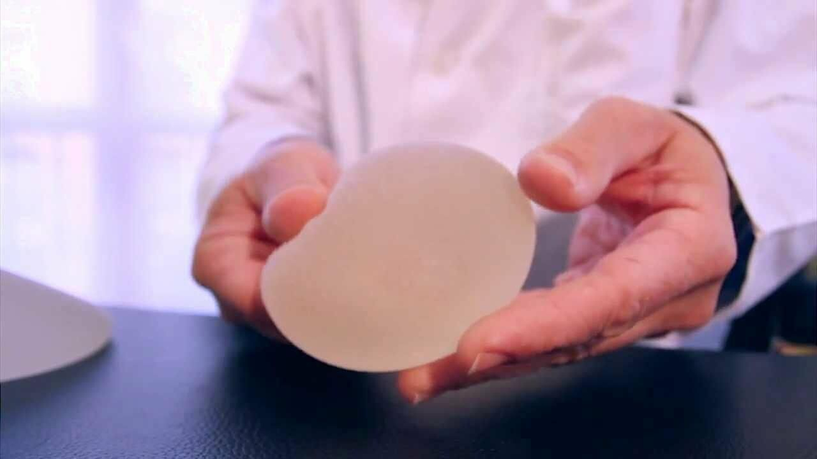 Imagen de archivo de una prótesis mamaria.