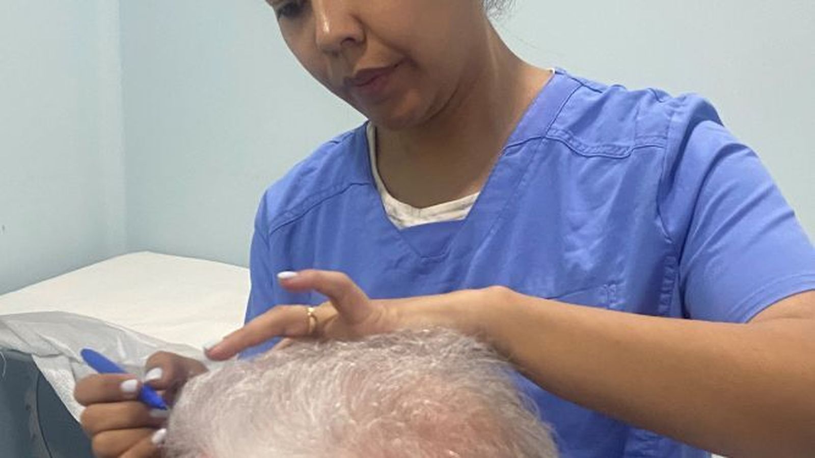 Griselda Duarte es experta en medicina capilar.