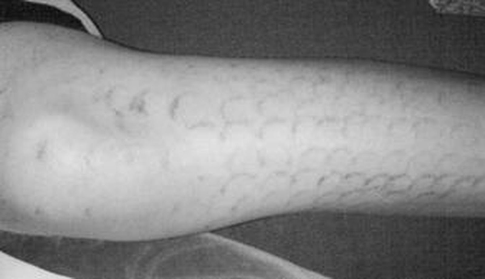 Así le quedaron las piernas a la afectada tras la sesión.