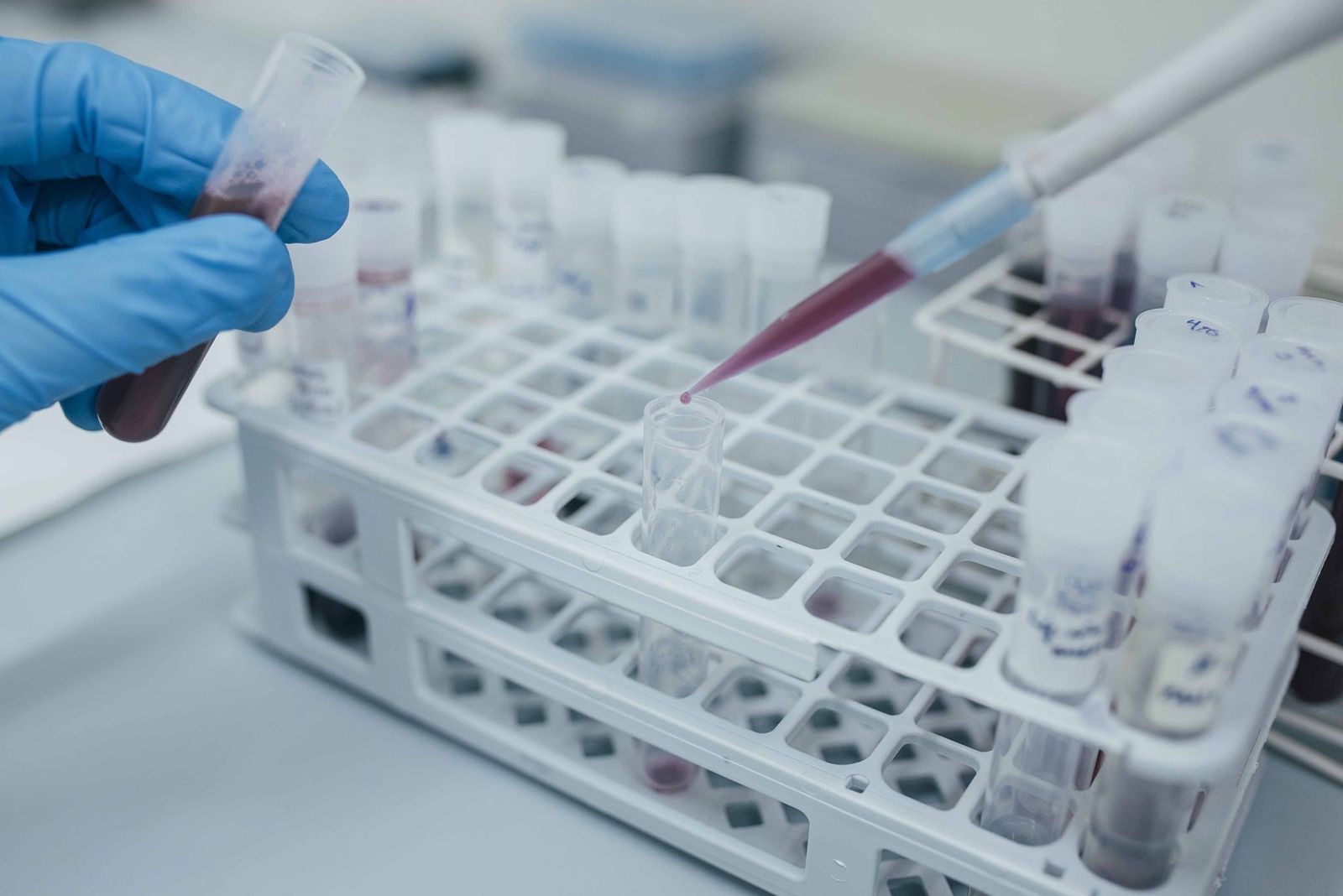 Manipulación de muestras en un laboratorio.