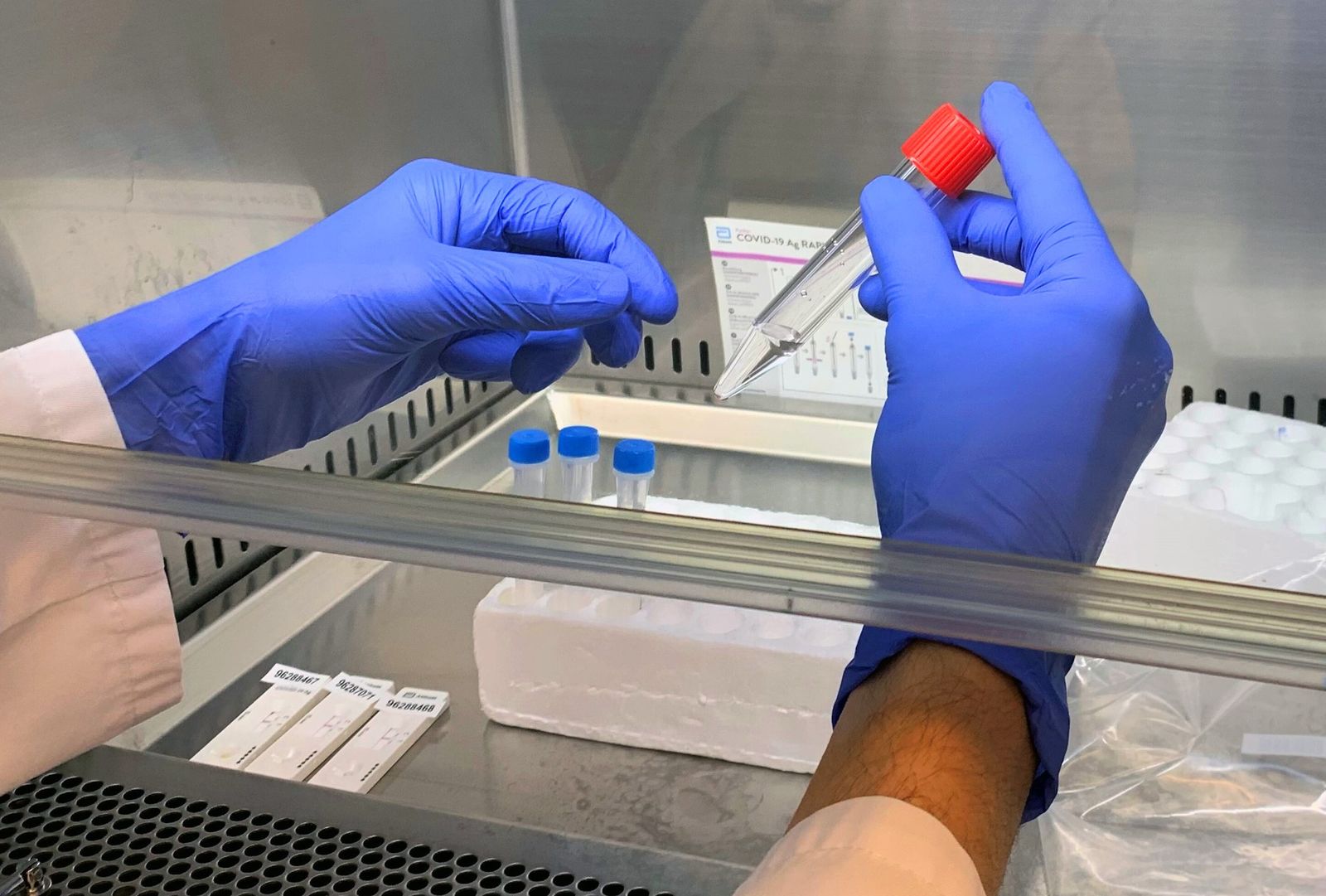 Un test de saliva para la detección del covid-19.