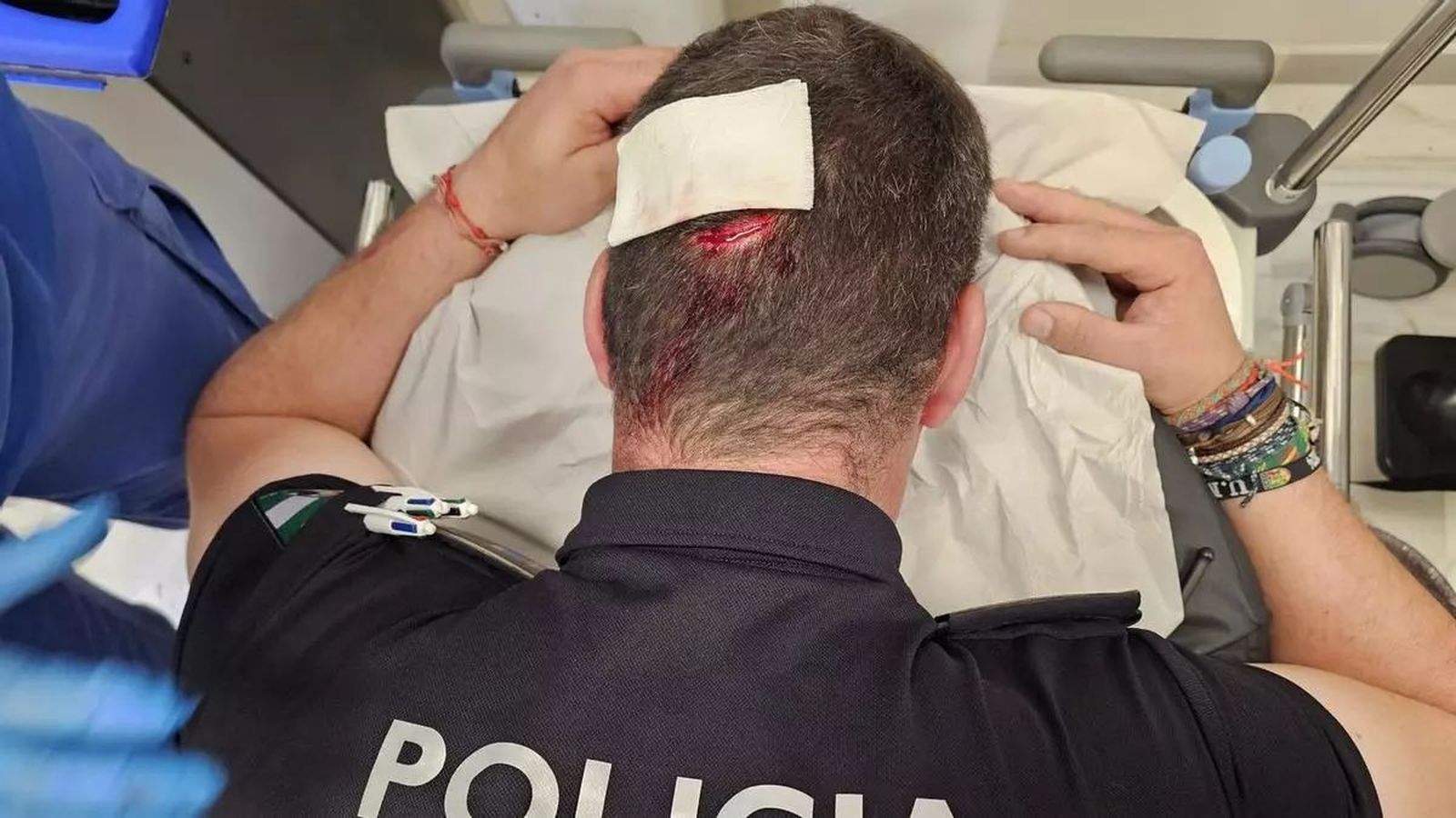 Así quedó la cabeza de uno de los policías.