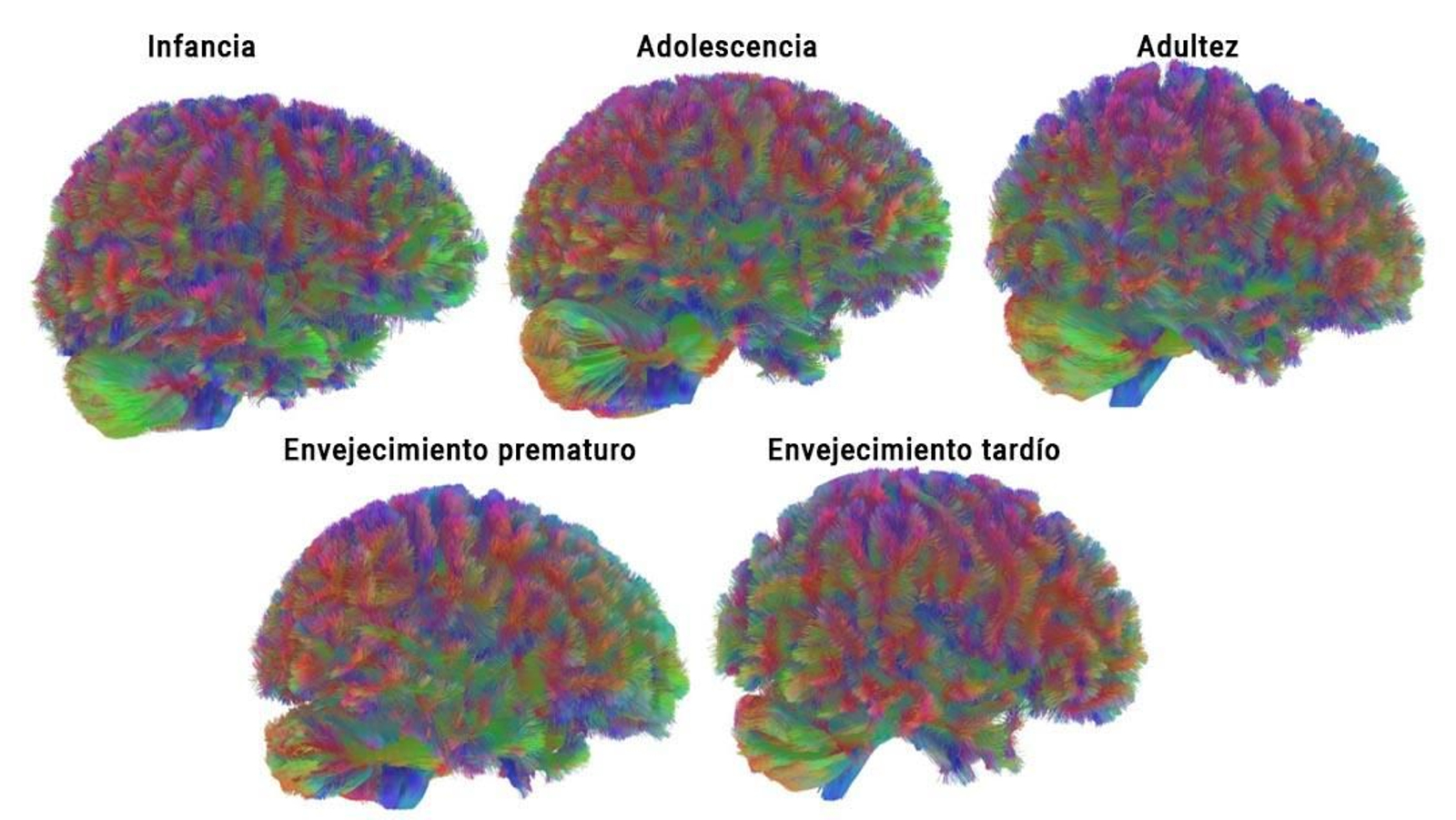 Cada etapa del cerebro humano.