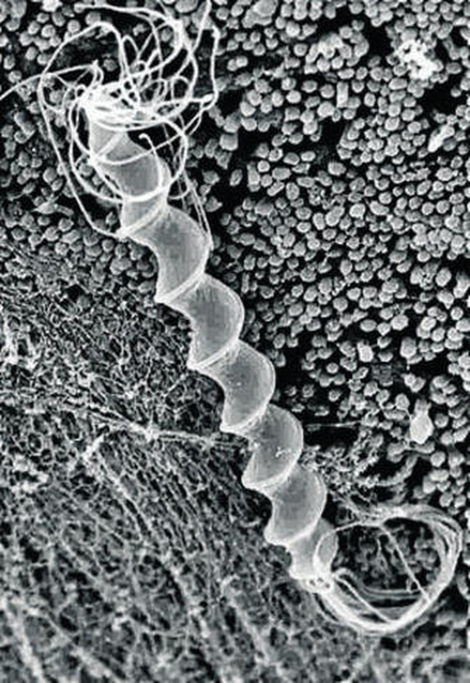 El Helicobacter pilori.