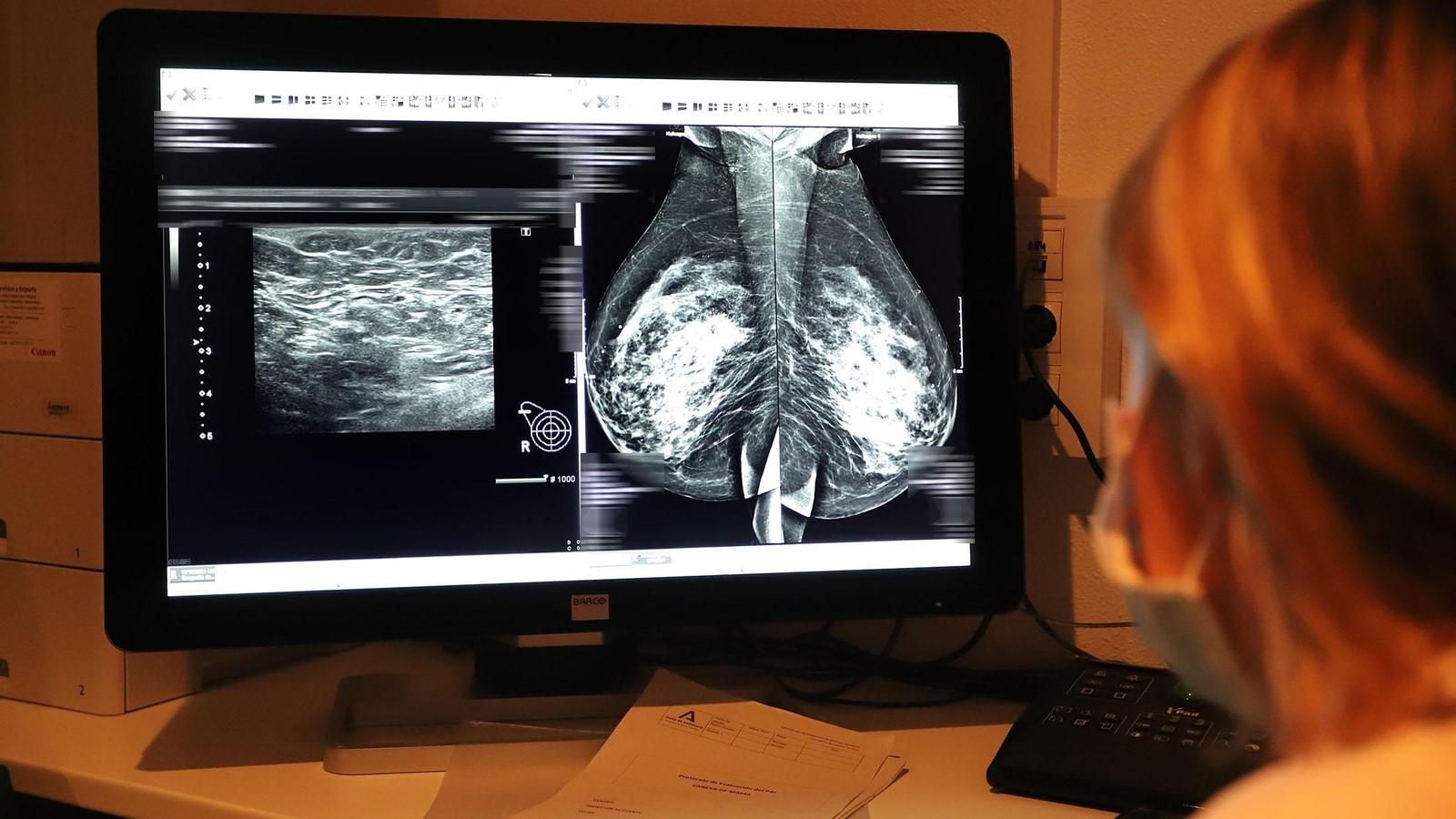 Una sanitaria evalúa una mamografía en un hospital de Huelva.