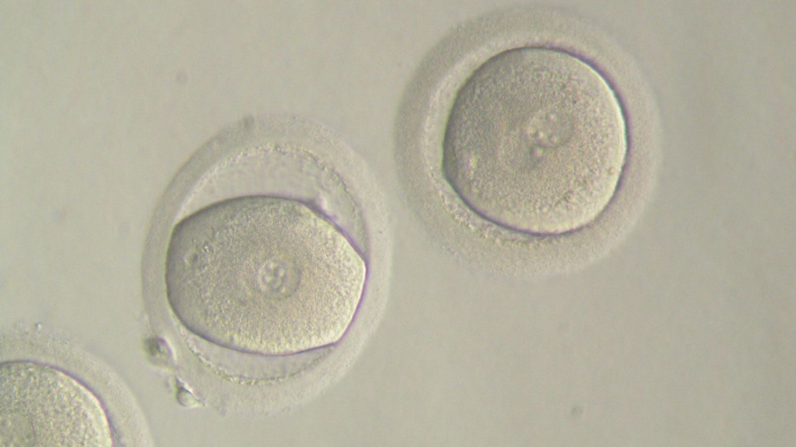 SIGNOS DE FECUNDACION EN EL PRIMER DÍA