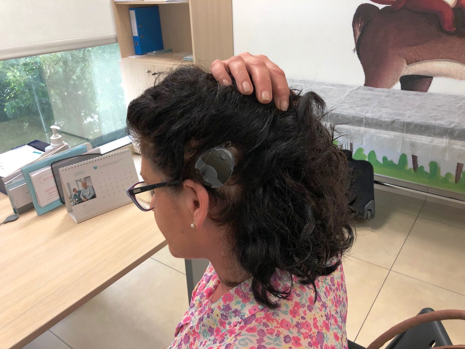 Implantes cocleares.