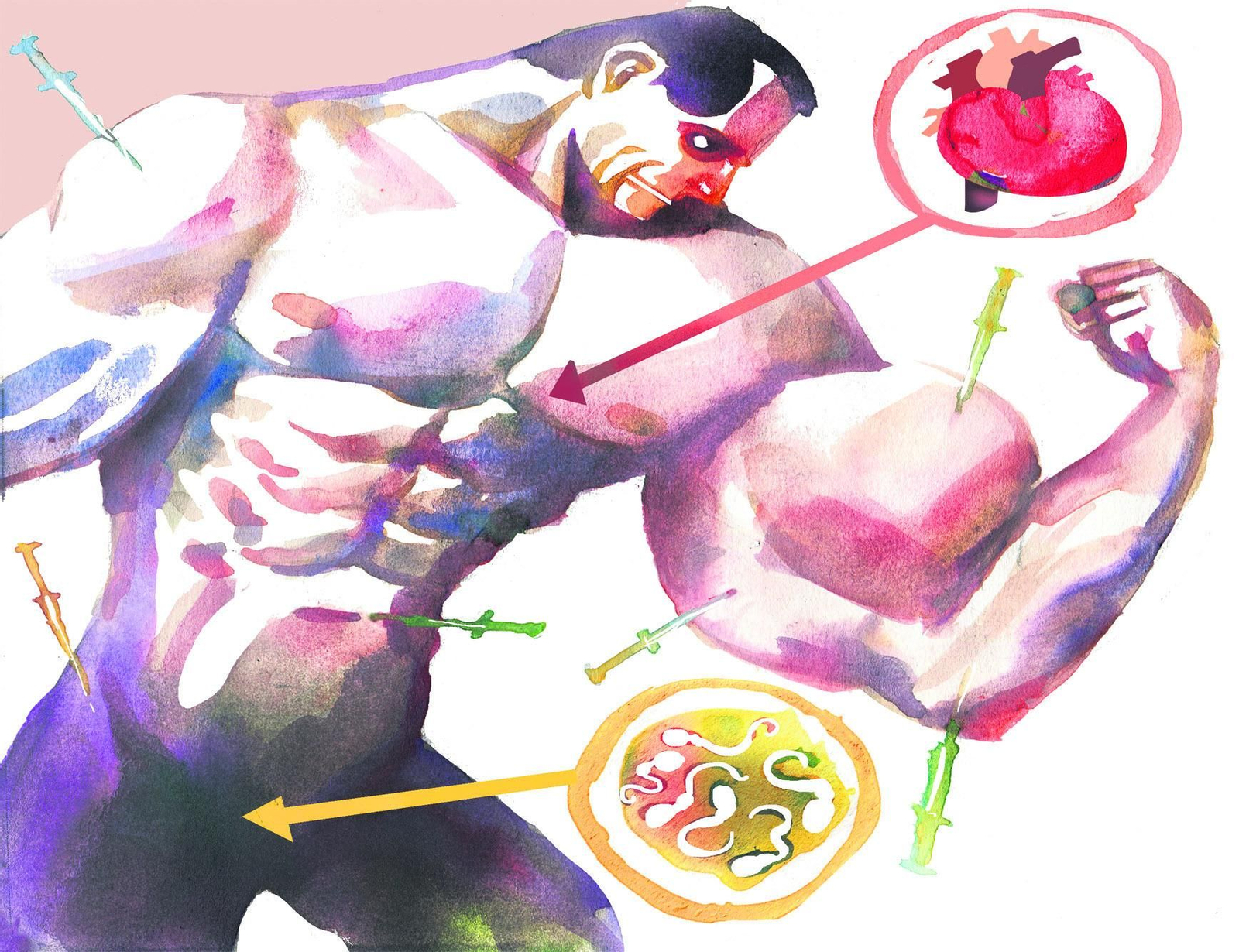 El precio de tener demasiado músculo