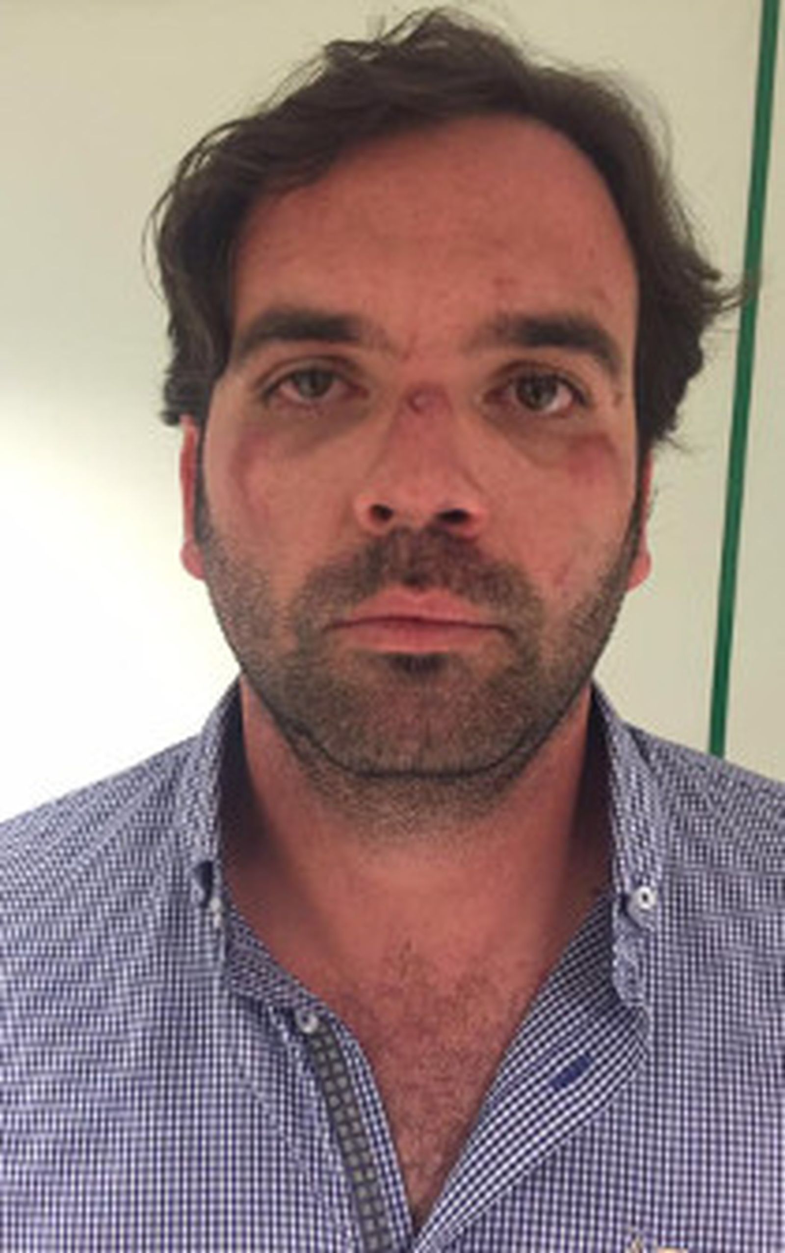 Amigos muestran en las redes al concejal con heridas en el rostro