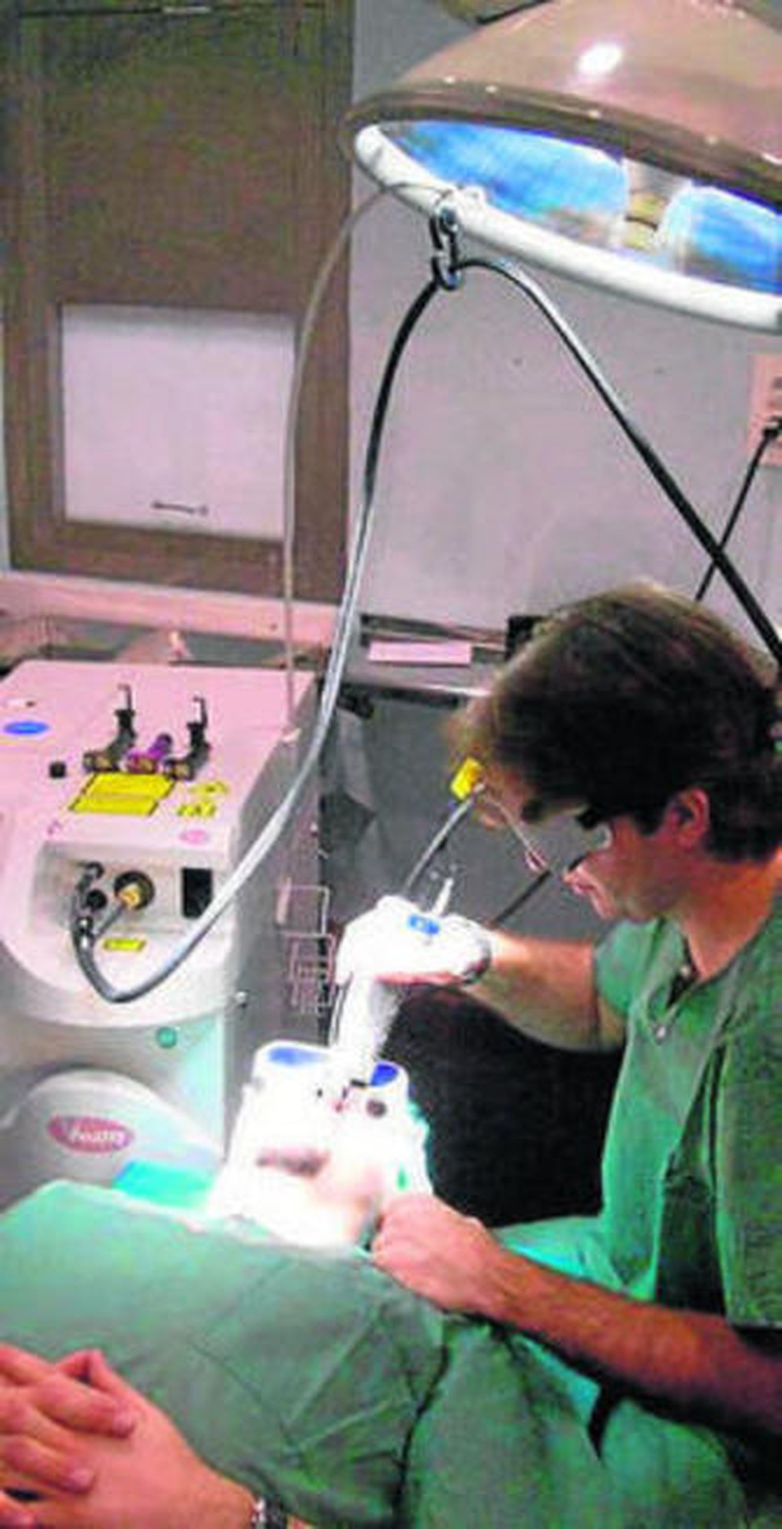 Tratamiento con láser.