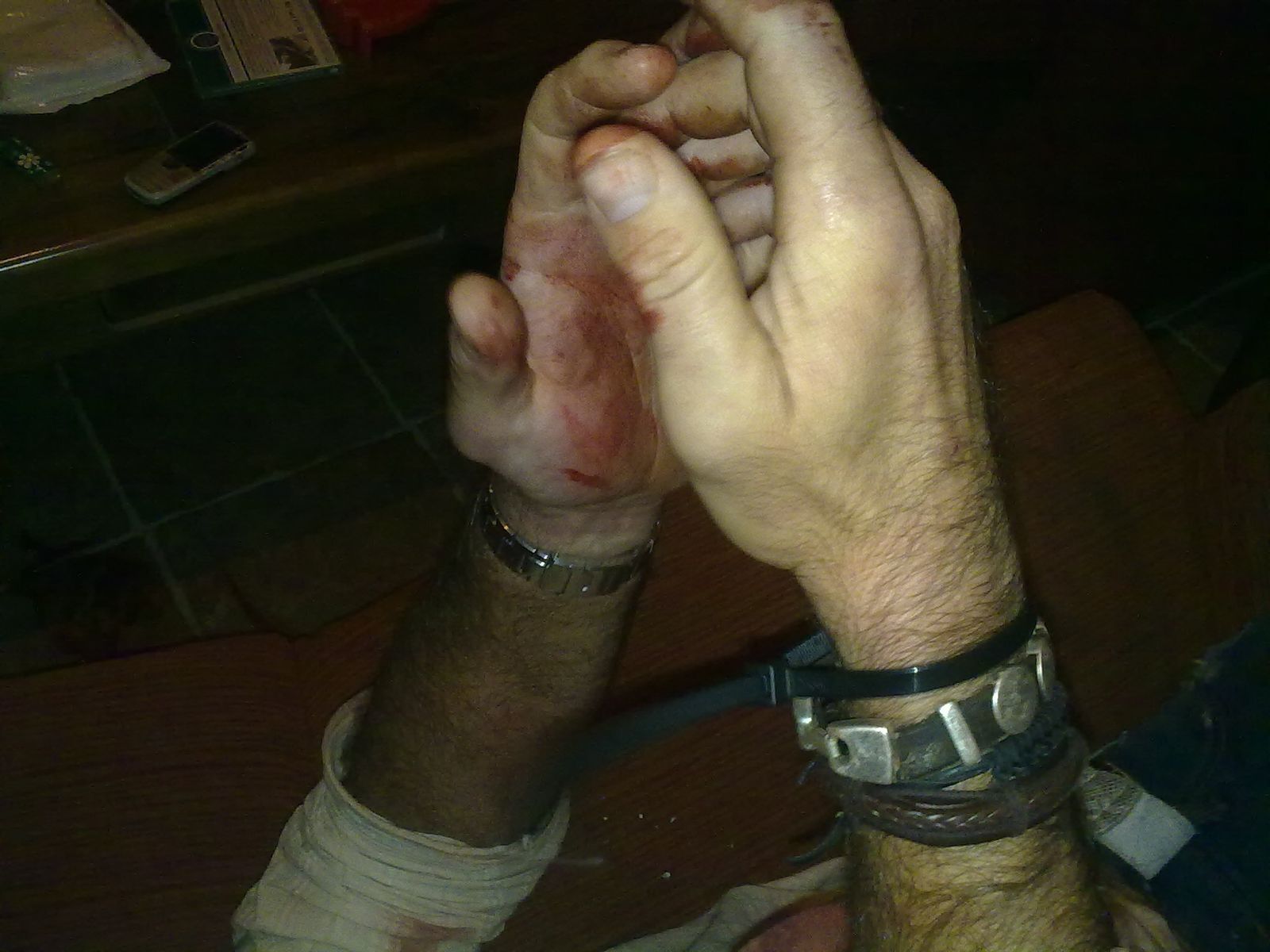 Las manos de un hombre torturado por sicarios en una operación en Cádiz.