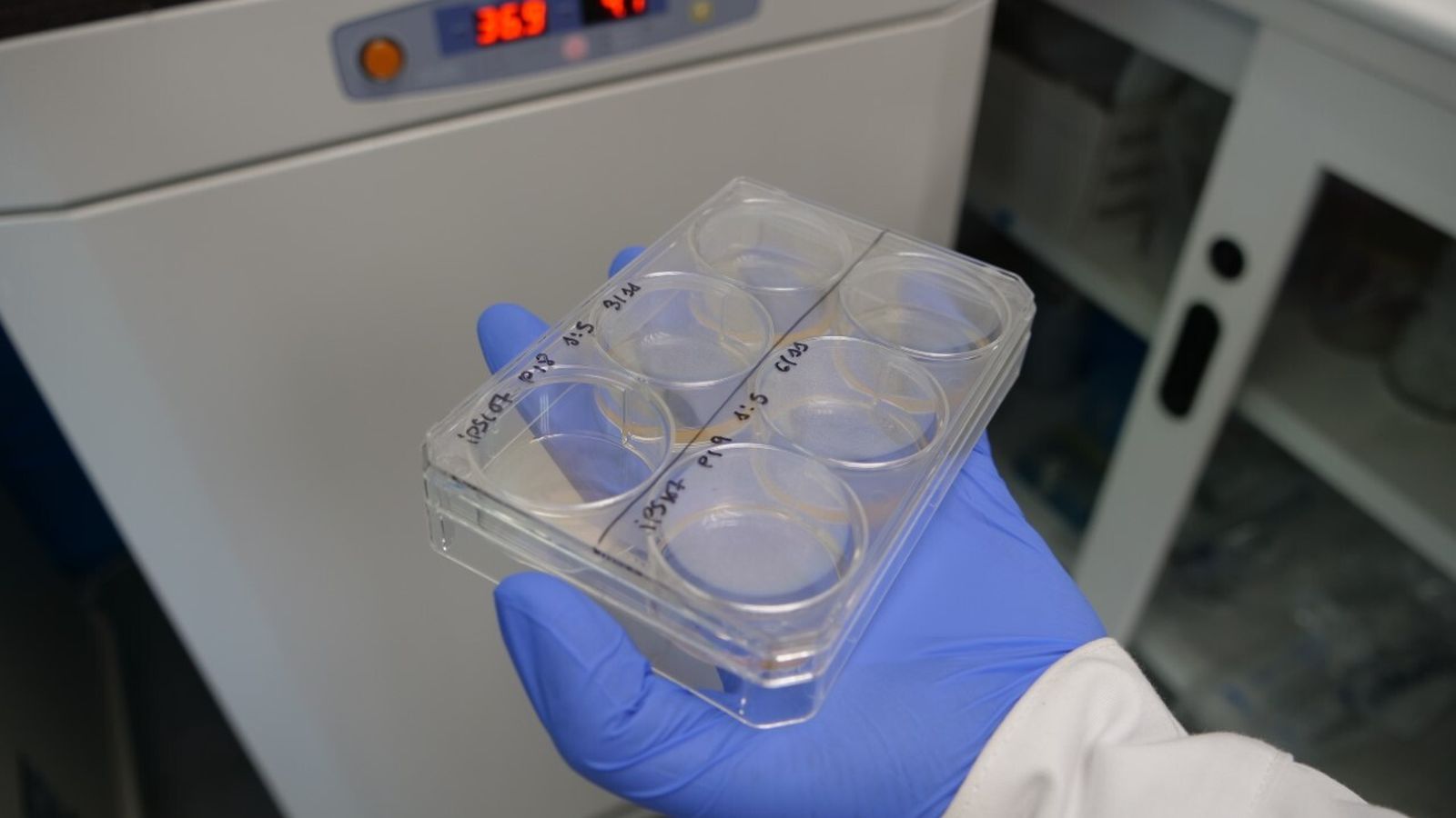 Muestras para el trabajo en el laboratorio.