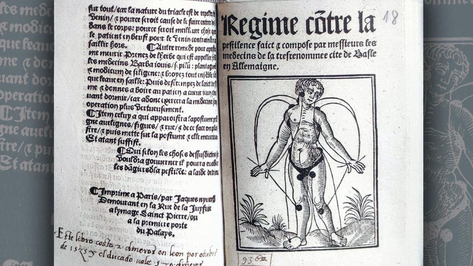 Regime contre la pestilence.