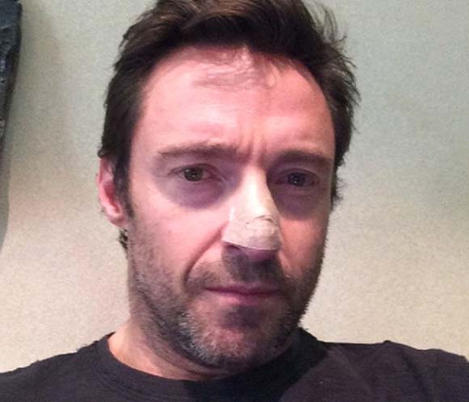 Hugh Jackman revela que padece cáncer de piel