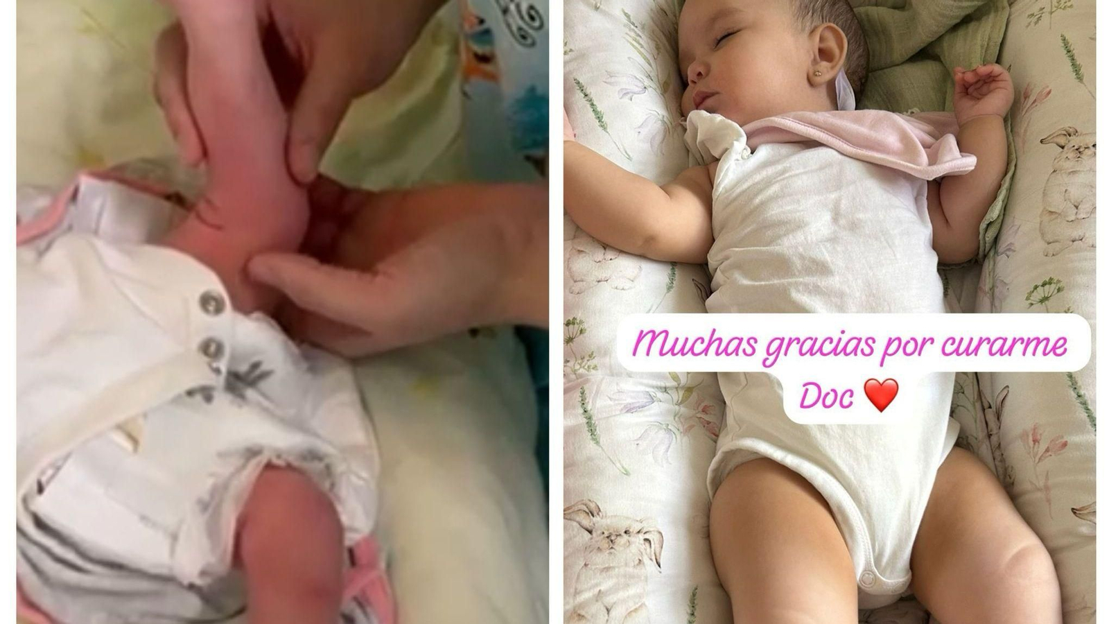 La pequeña con el problema de luxación congénita de rodilla durante y después de la dolencia