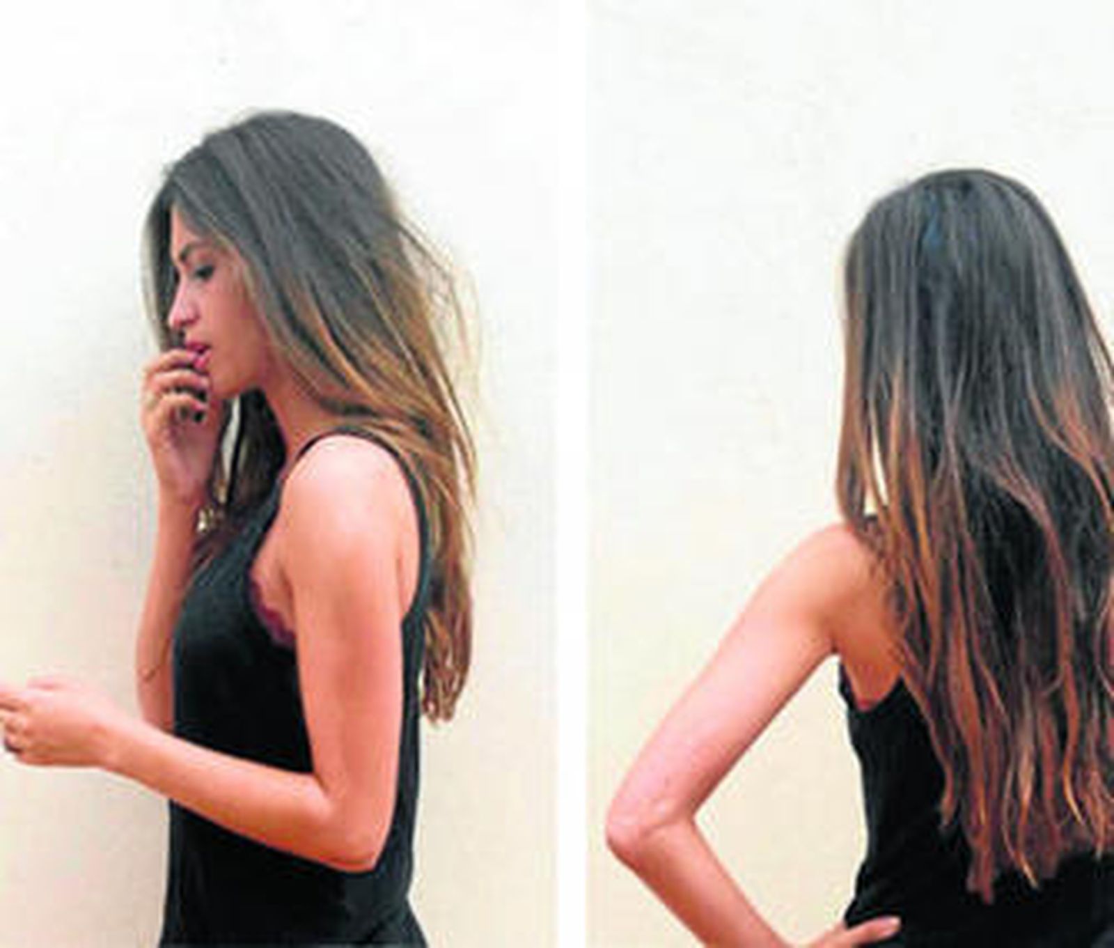 Sara Carbonero ha colgado en su blog una foto de una mancha y otra de una cicatriz.