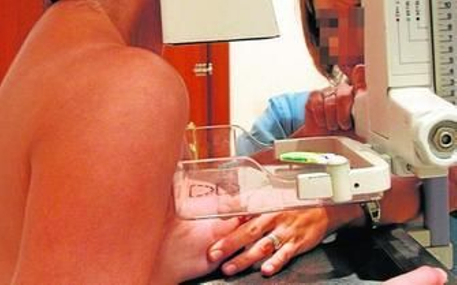 Una mujer se somete a una mamografía.