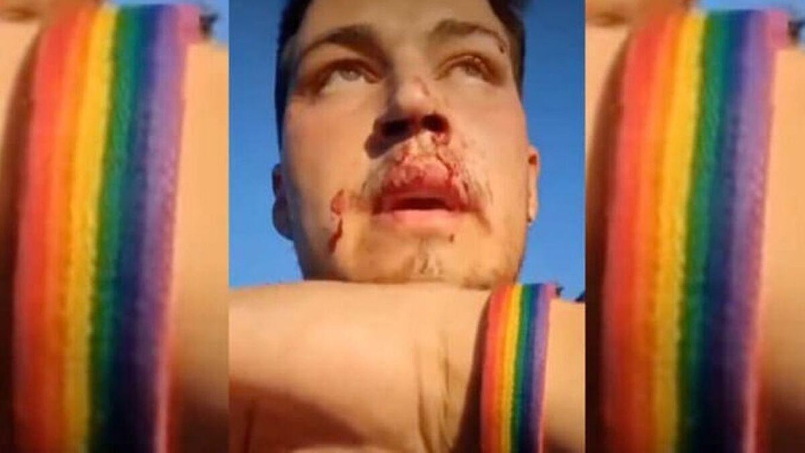 Denuncia de la paliza sufrida por un trabajador de un chiringuito el pasado 21 de julio.