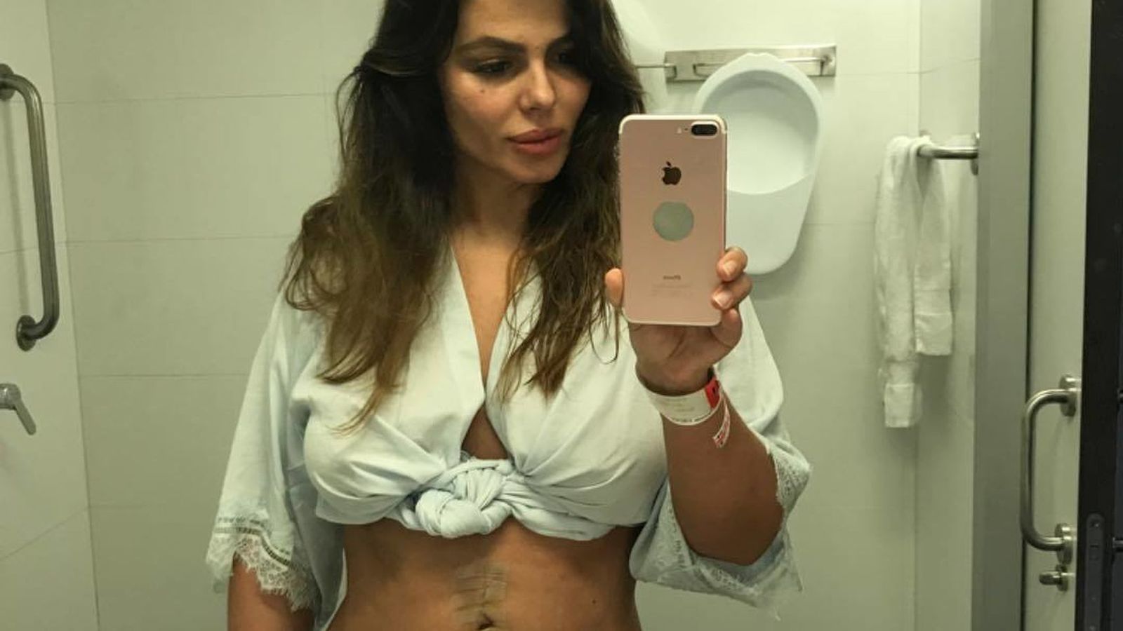 Marisa Jara muestra públicamente la cicatriz de su operación.