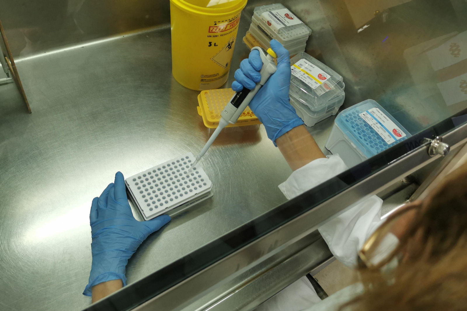 Detalle del Laboratorio de Microbiología de Valme en el proceso diagnóstico de muestras.