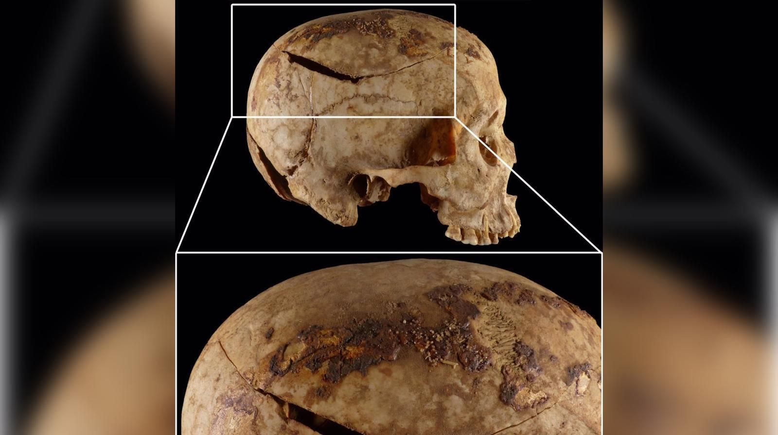 Imagen compuesta de uno de los cráneos estudiados, procedente de la necrópolis de Qubbet el-Hawa.