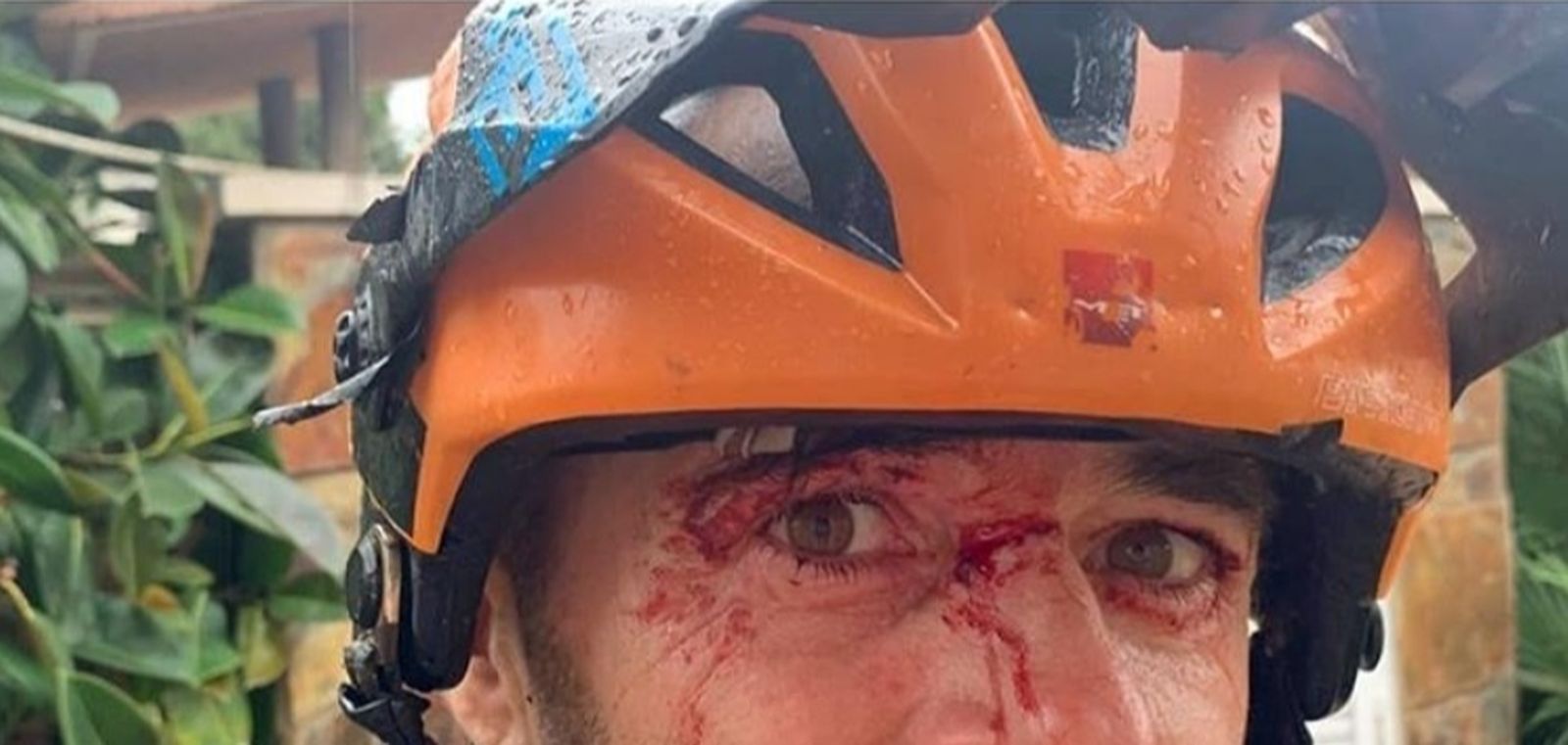 Una trampa en un sendero está a punto de dejar ciego al ciclista Miguel Castillejos