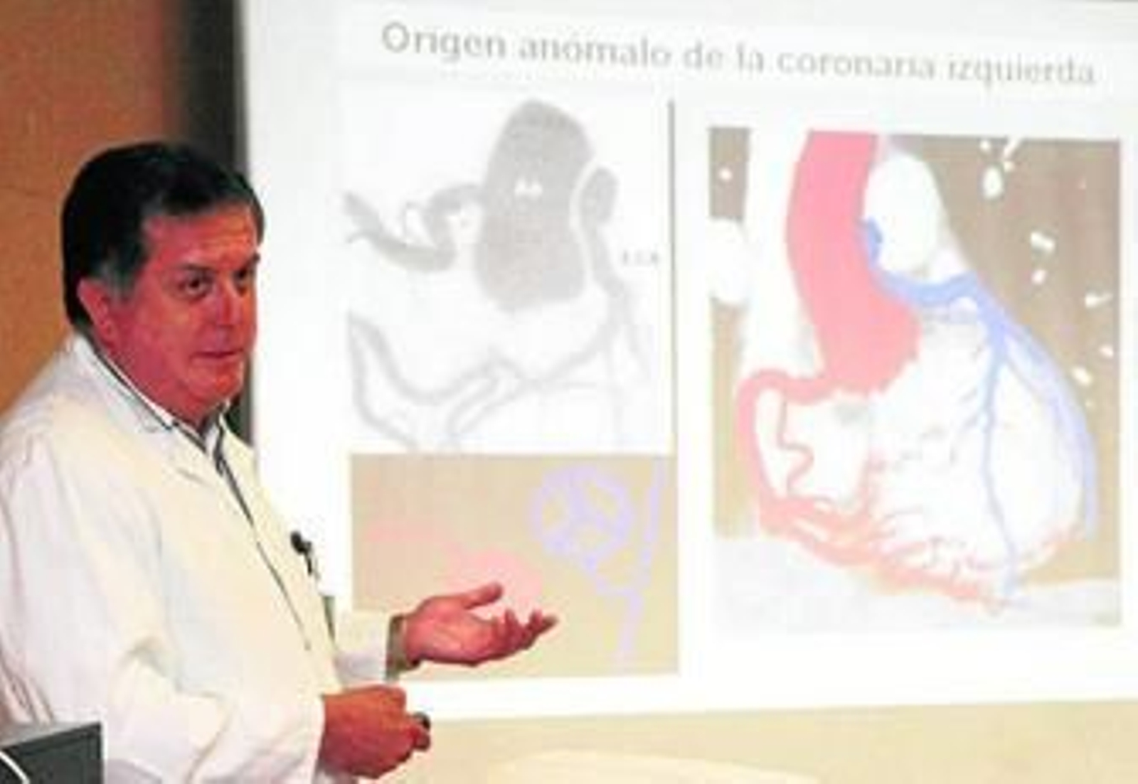 El doctor Casares explica una de las últimas intervenciones realizadas a un bebé de 18 meses.