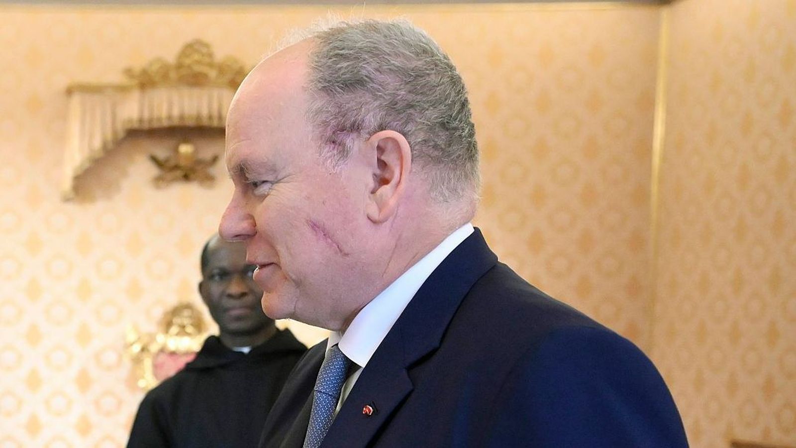 Aspecto de la cicatriz que presentaba el príncipe Alberto en la audiencia papal