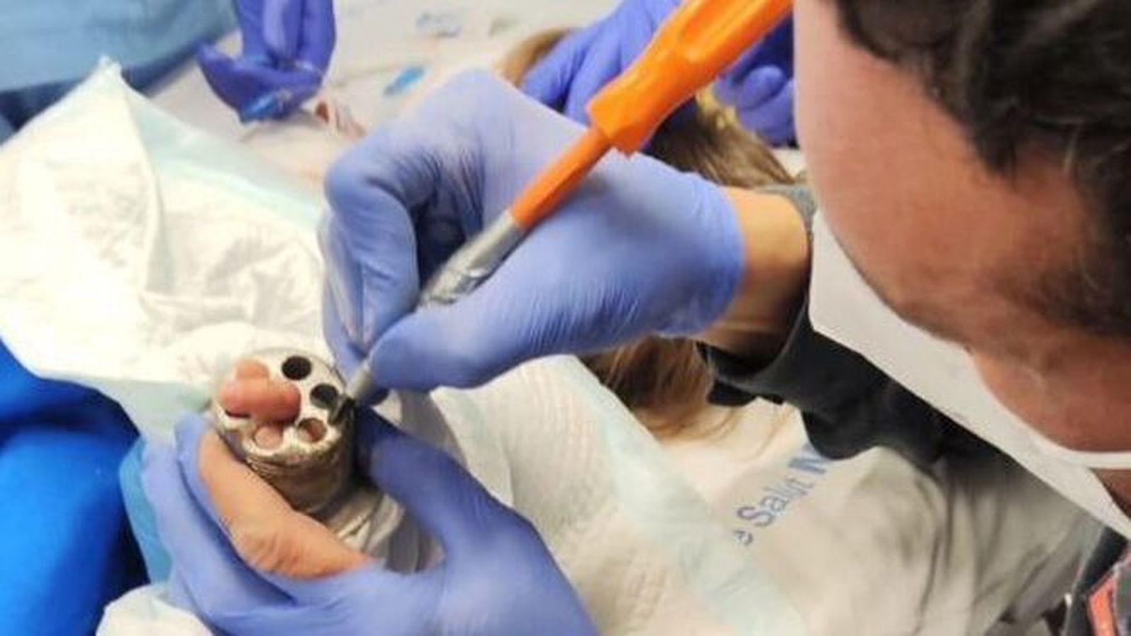 Los servicios sanitarios intervienen para sacar el dedo del menor.