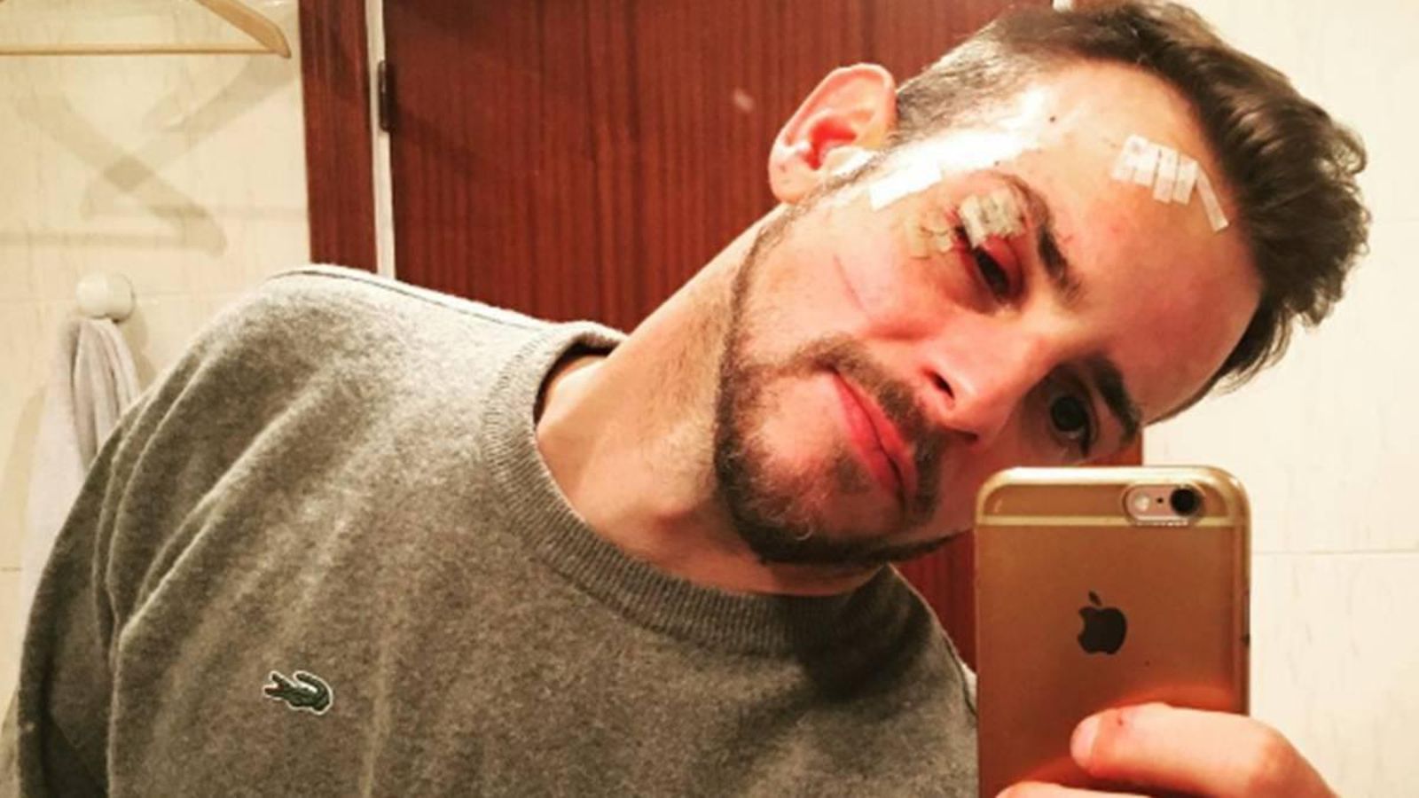 Casademunt mostrando las secuelas de la agresión sufrida en 2017