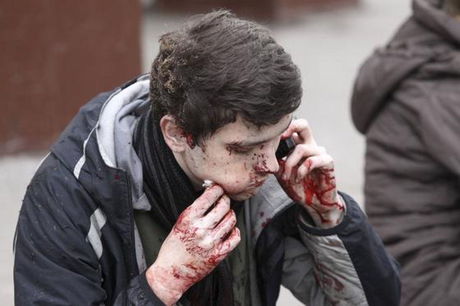 Un joven habla por telefono ensangrentado. / Reuters