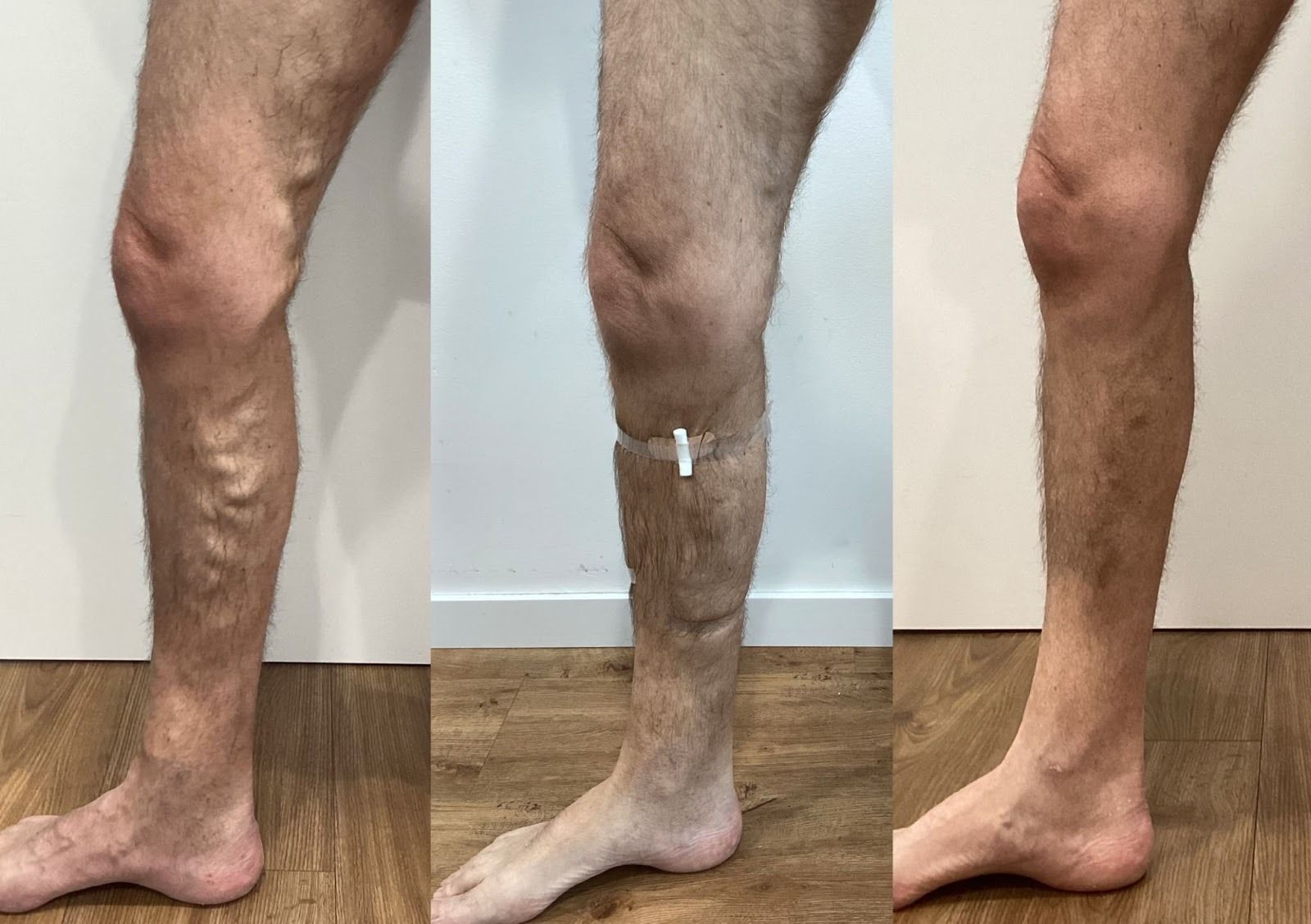 Resultados antes y después del tratamiento