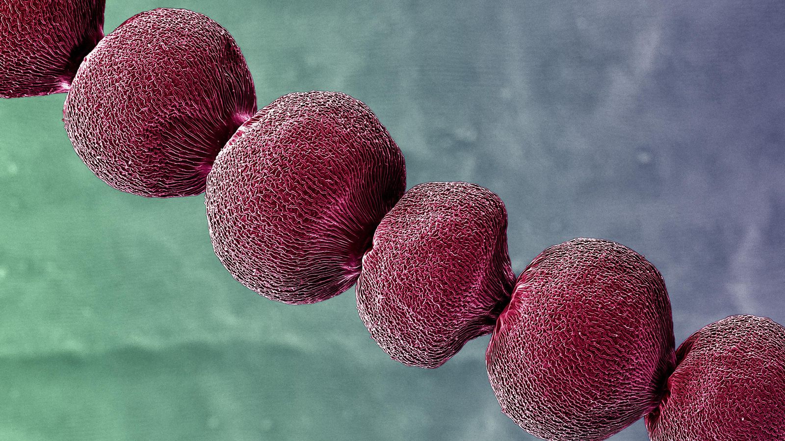 Fotografía 'Biosensores'